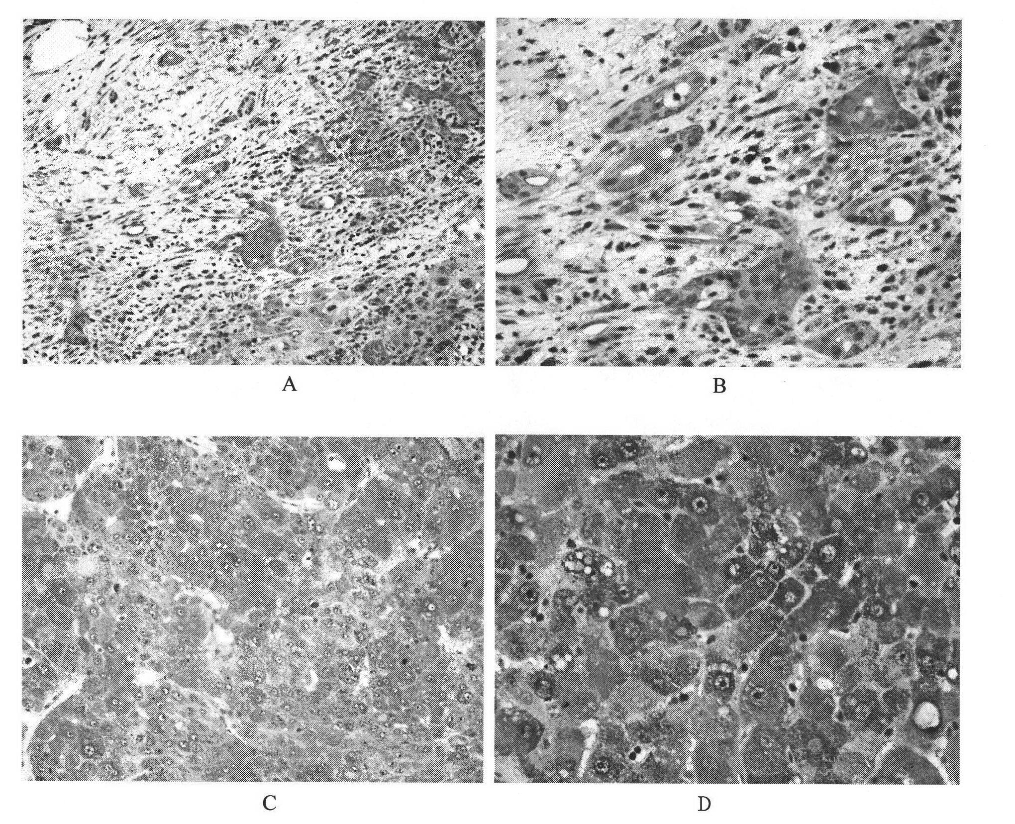 Monoclonal antibody of anti-human SIRPalpha, cell strain, preparation method and application thereof