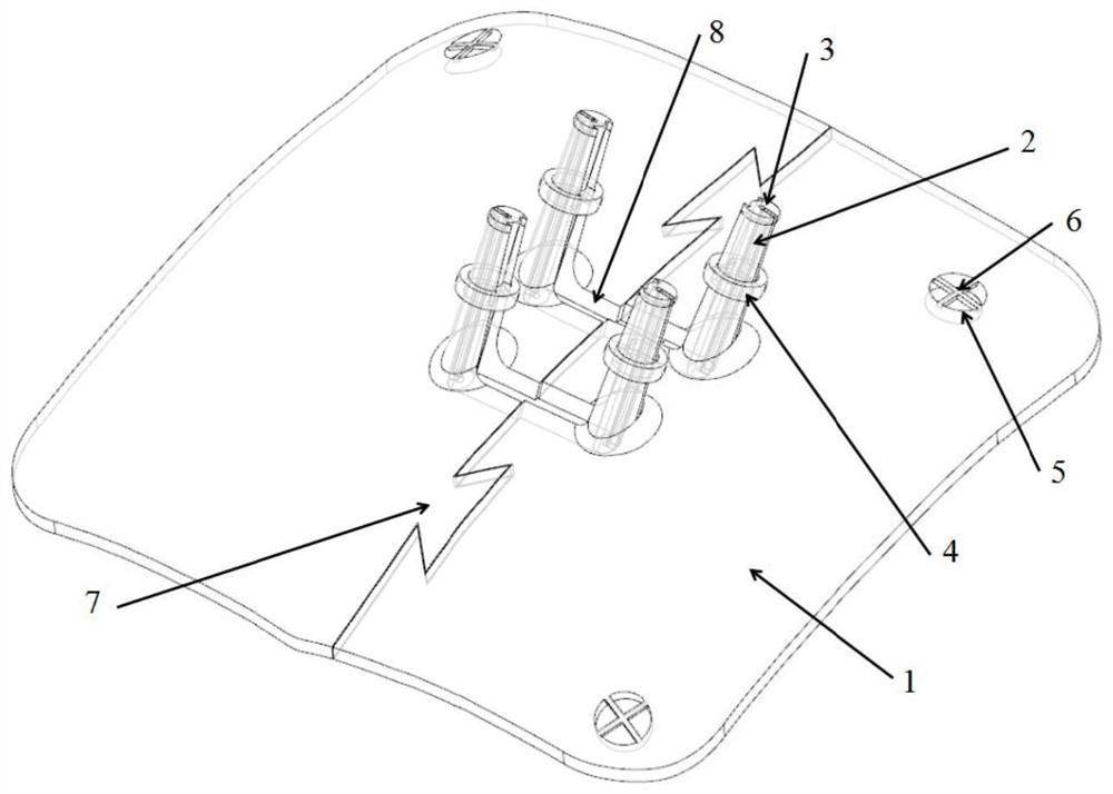 Sacral nerve puncture guide plate and construction method thereof