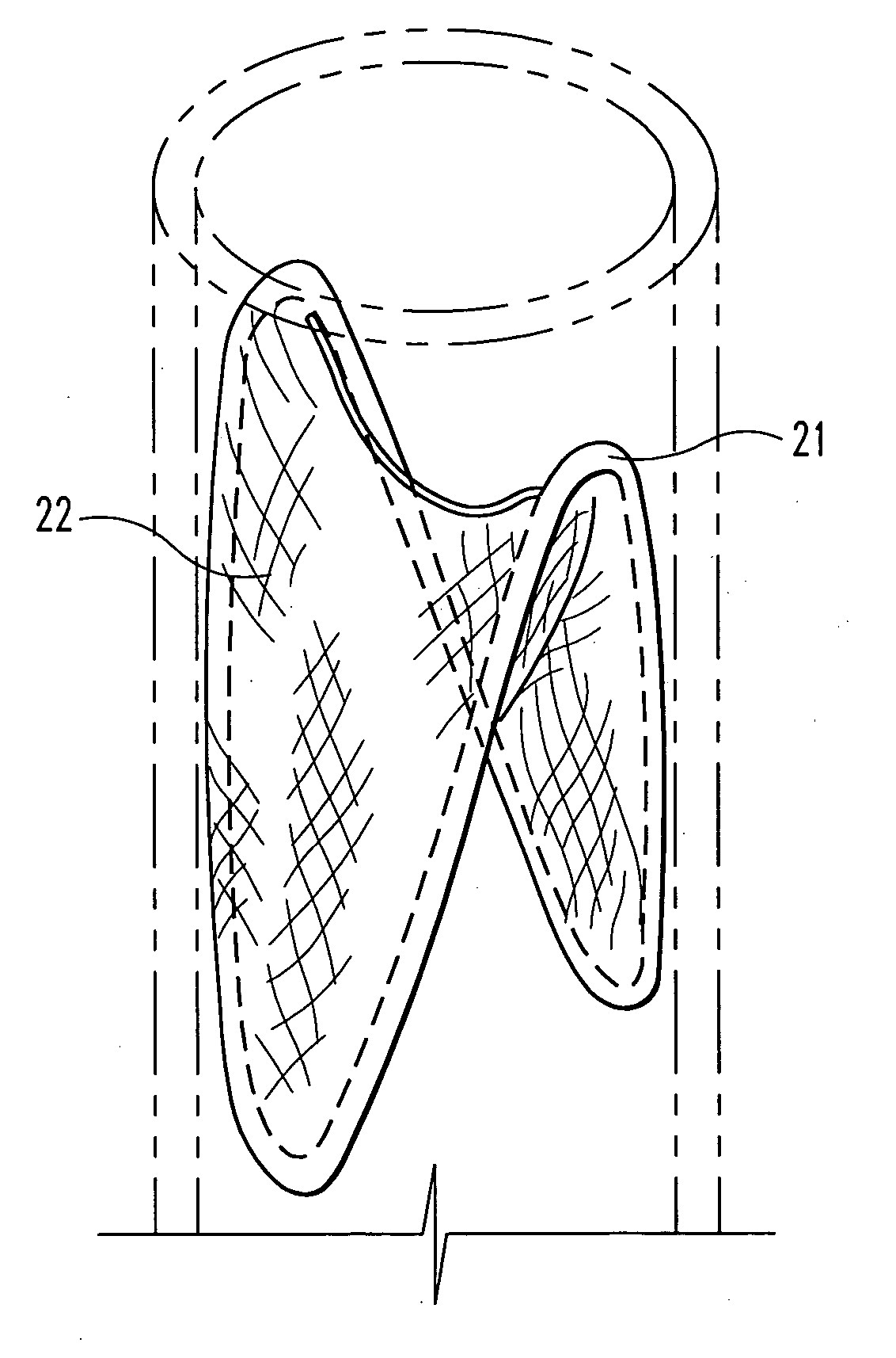 Graft prosthesis devices containing renal capsule collagen