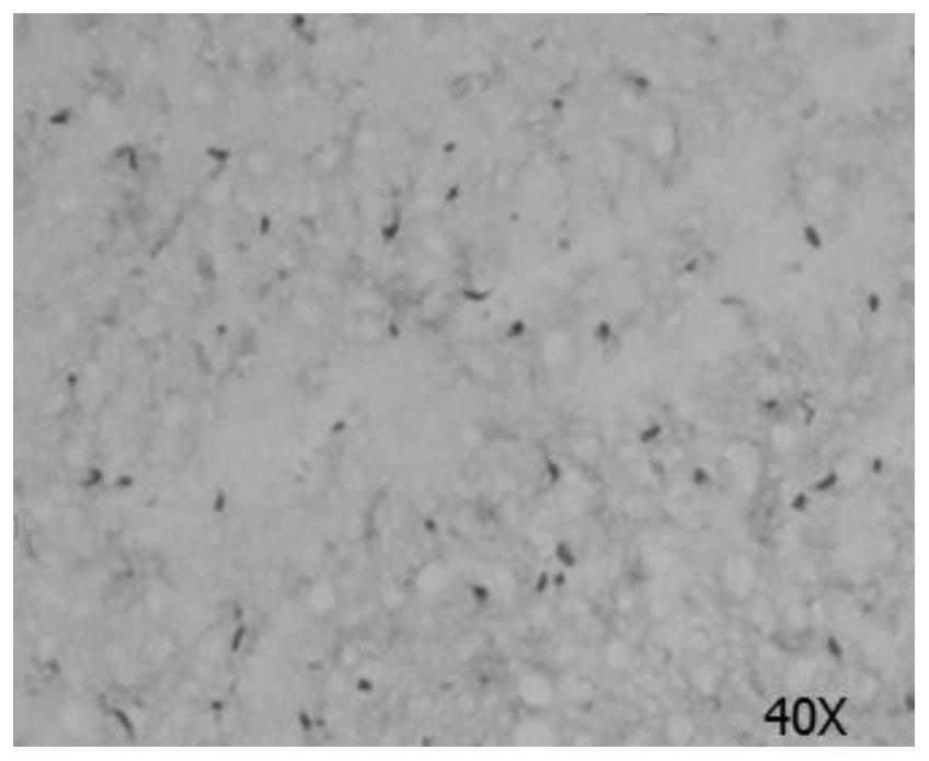 A systematic method and application of preparation and cryopreservation of placental tissue according to the structure level