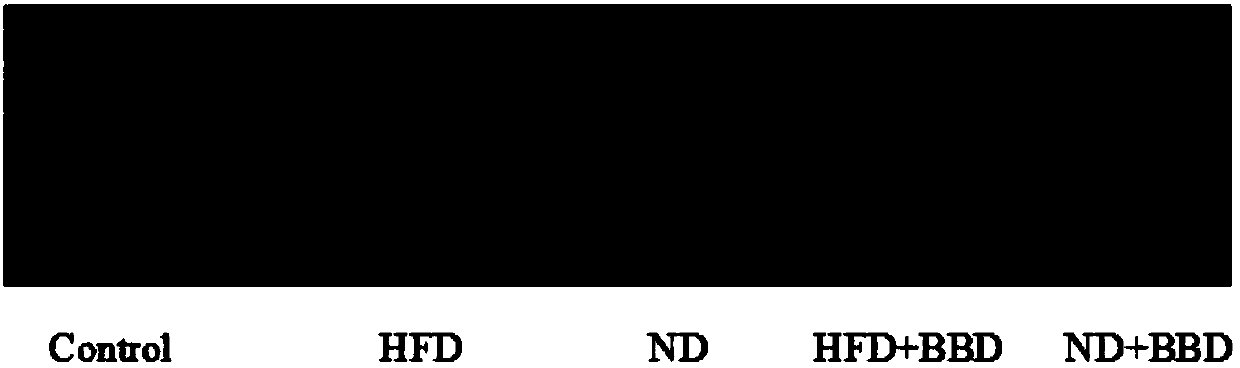 Applications of eight-treasure pills in preparing medicines for treating non-alcoholic fatty liver diseases