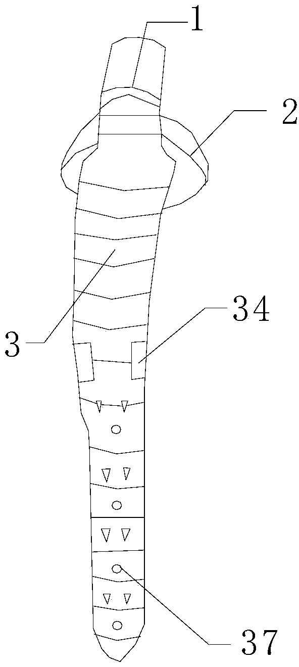 Biotype artificial hip joint femoral component