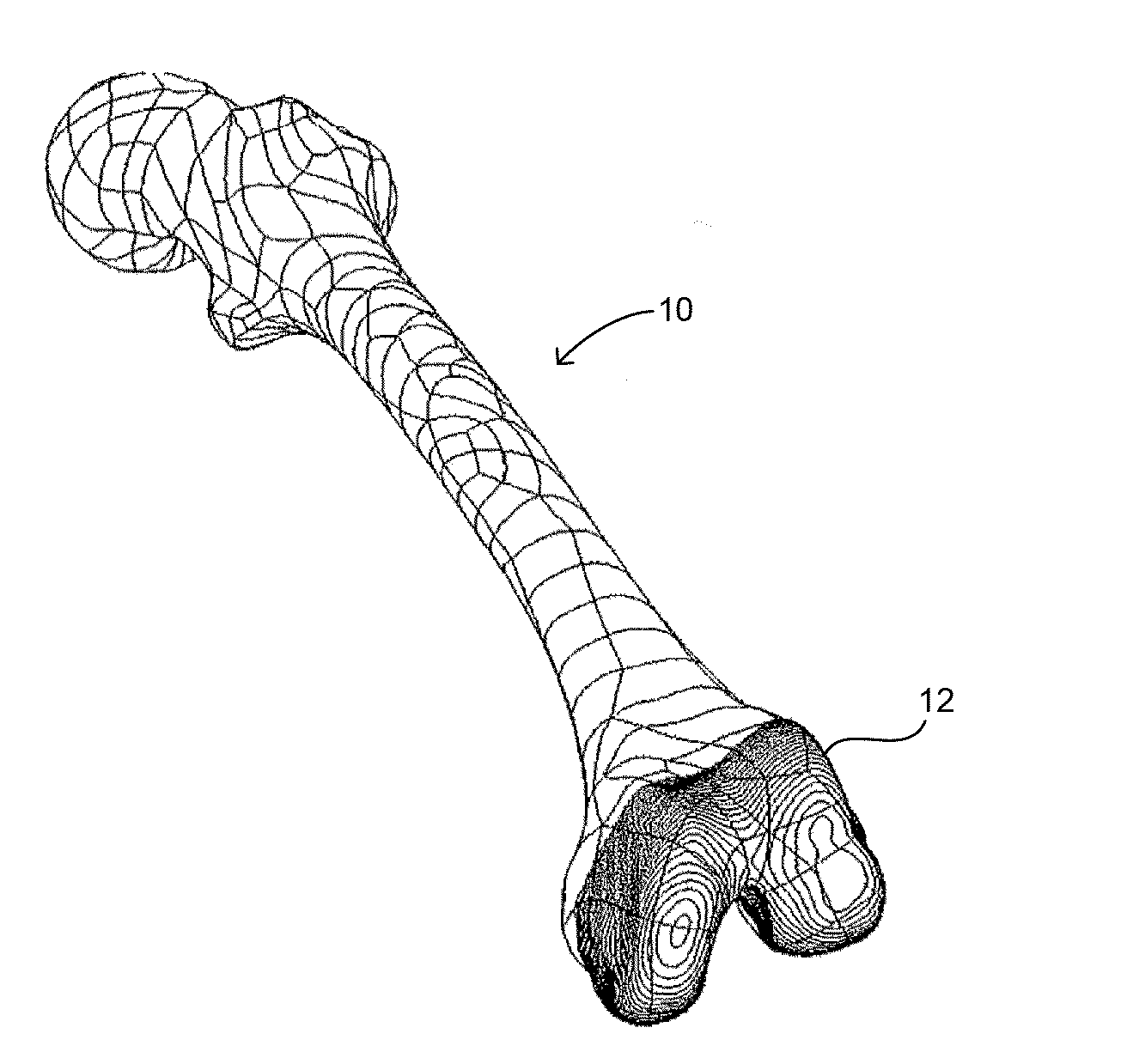 Extended patellofemoral