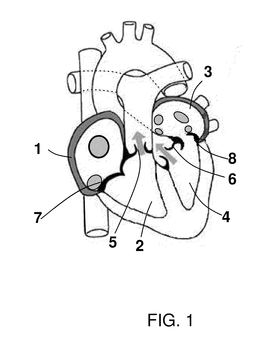 Annuloplasty tubes