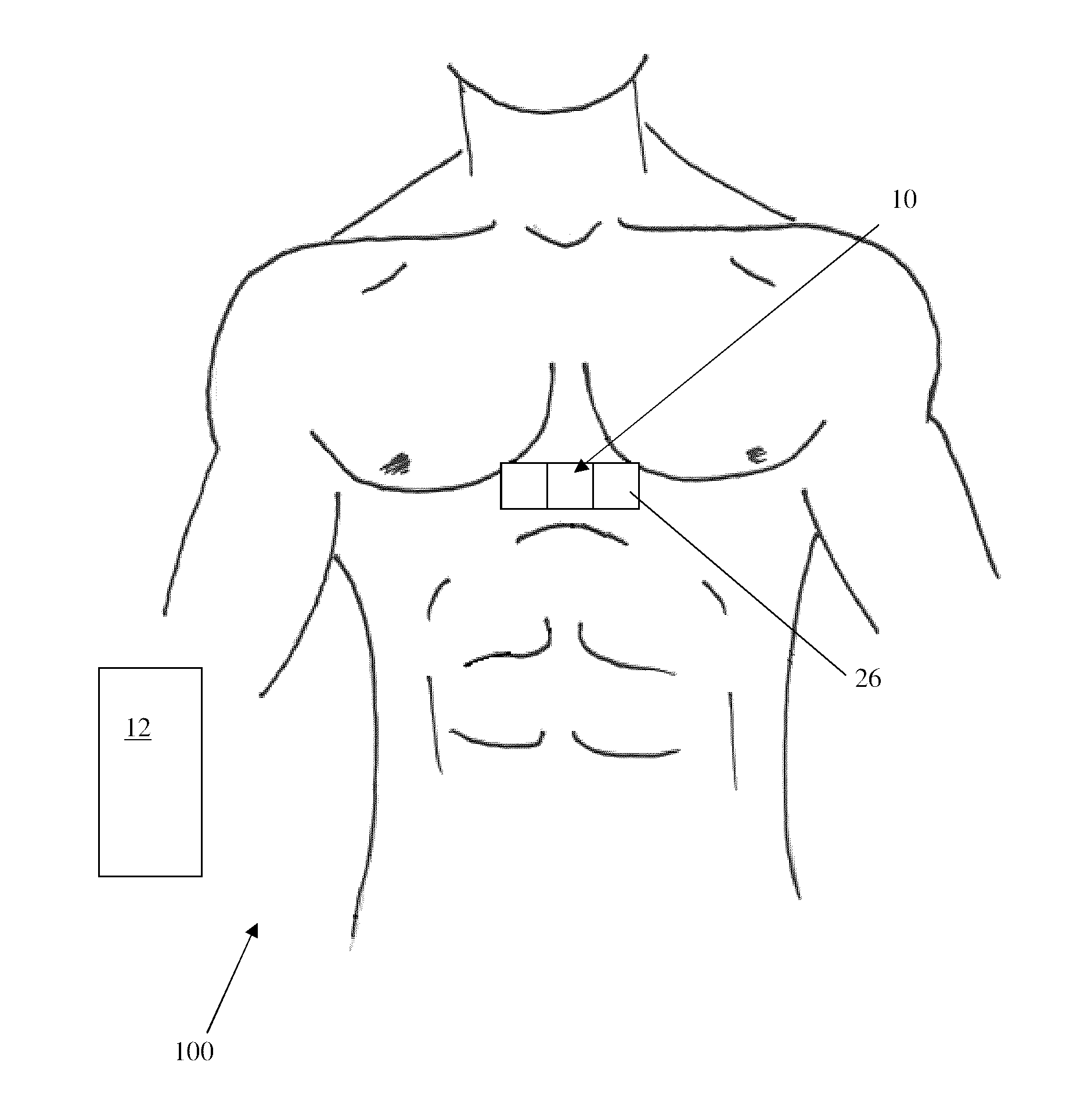 Method and apparatus for obtaining and processing ballistocardiograph data