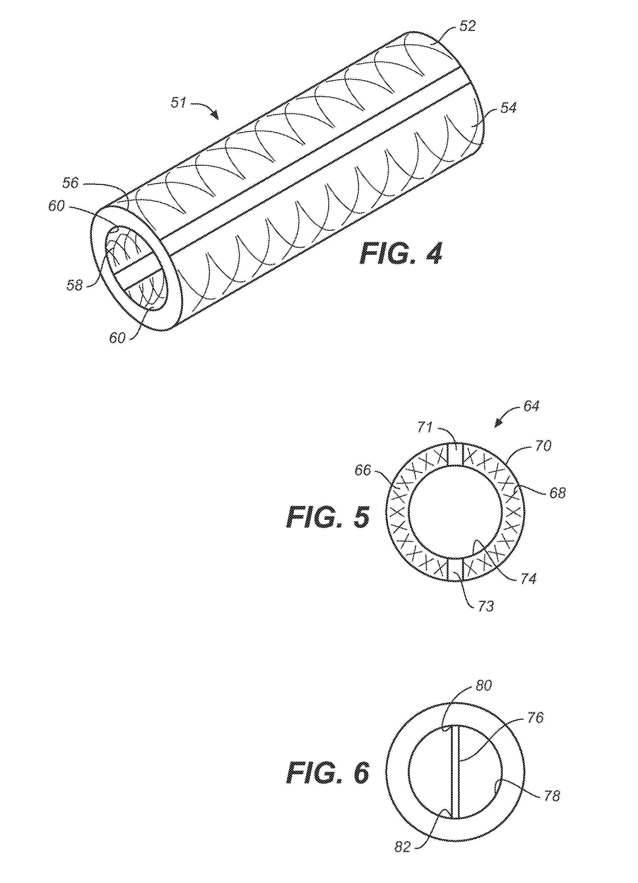 Electrochemical disinfection of implanted catheters