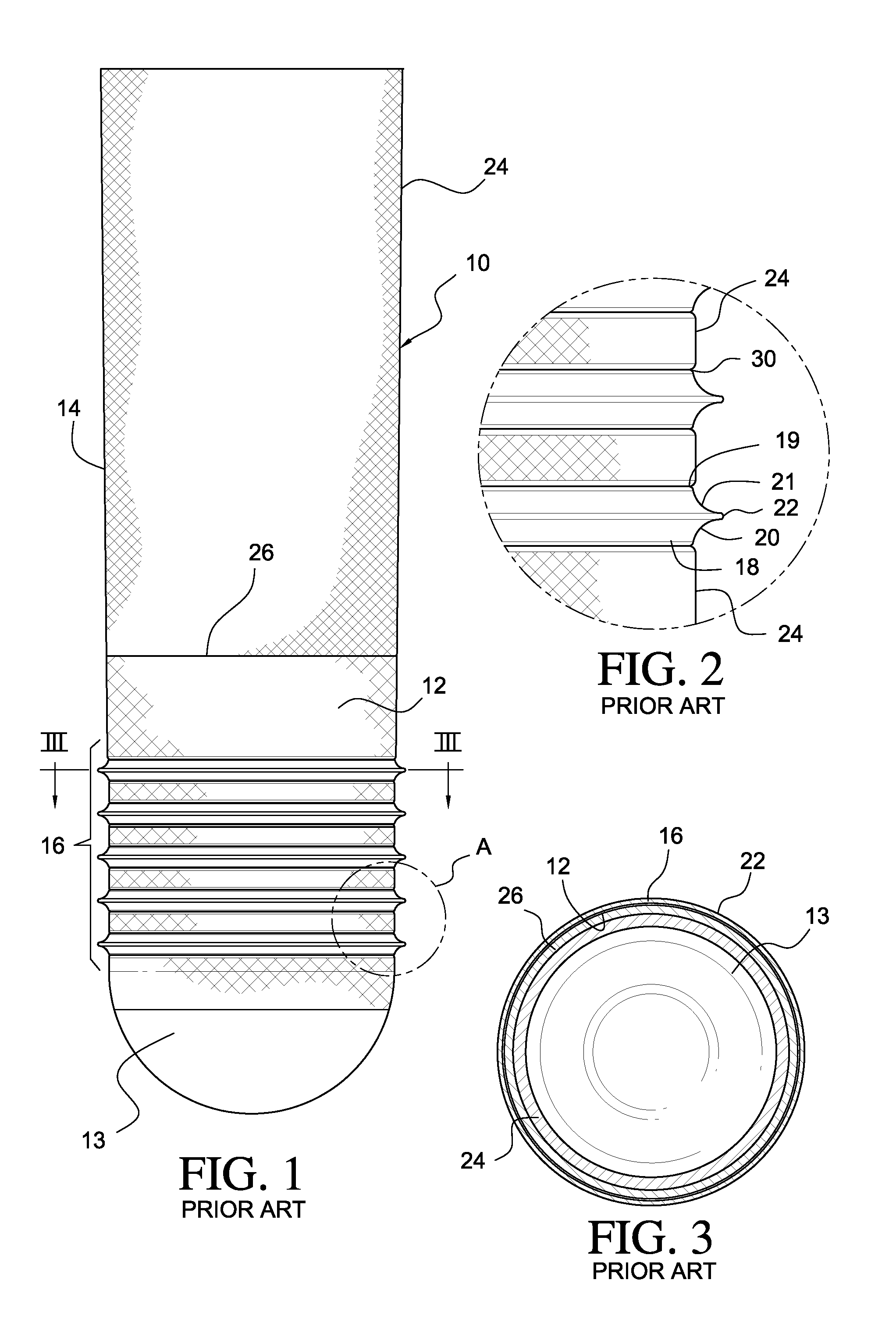 Suspension liner system with distensible seal