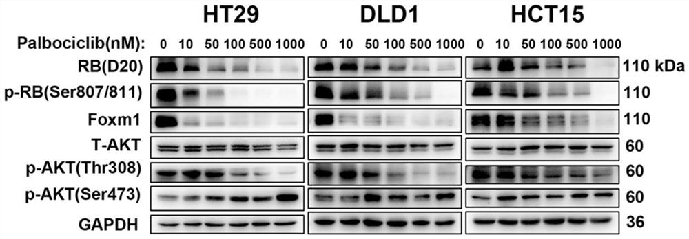 EGFR and CDK4/6 small molecule targeted drug composition and application thereof