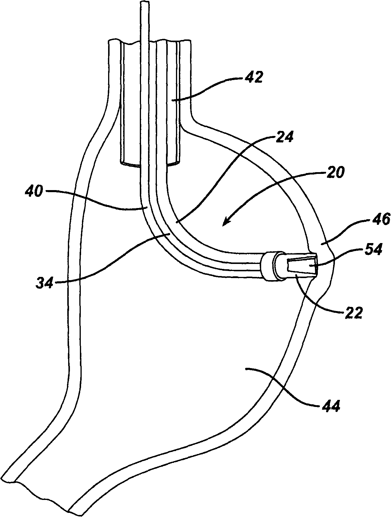 Device for folding and fastening gastric tissue