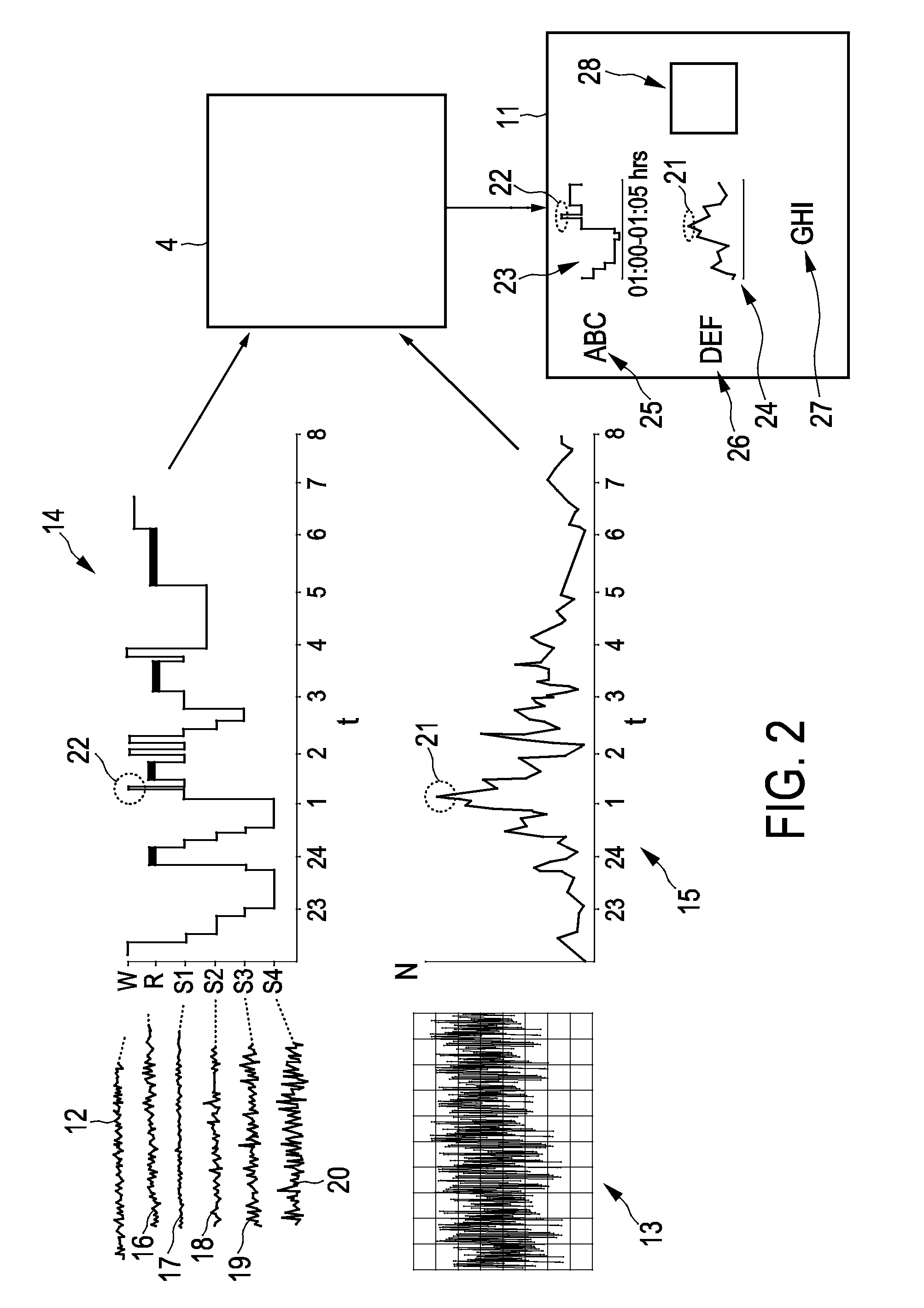 Sleep disturbance monitoring apparatus