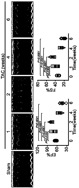 Application of VEGF-C (vascular endothelial growth factor-C)/VEGFR-3 (vascular endothelial growth factor receptor-3 signal medicated lyphangion genesis to prevention and treatment of cardiac failure