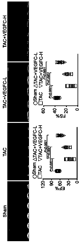 Application of VEGF-C (vascular endothelial growth factor-C)/VEGFR-3 (vascular endothelial growth factor receptor-3 signal medicated lyphangion genesis to prevention and treatment of cardiac failure