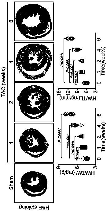 Application of VEGF-C (vascular endothelial growth factor-C)/VEGFR-3 (vascular endothelial growth factor receptor-3 signal medicated lyphangion genesis to prevention and treatment of cardiac failure