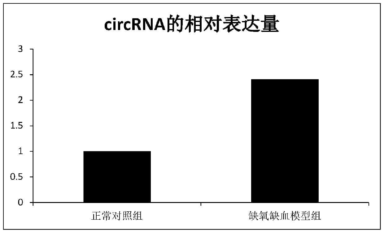 circRNA and application thereof in detecting hypoxic-ischemic brain damage