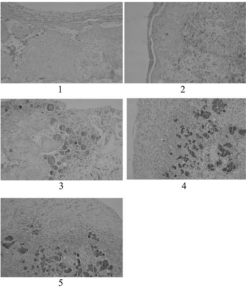 Injectable PLGA (poly(lactic-co-glycolic acid)) porous composite microsphere preparation embedded with BMP-2 and TGF-beta1 containing microspheres as well as preparation method and application of composite microsphere preparation