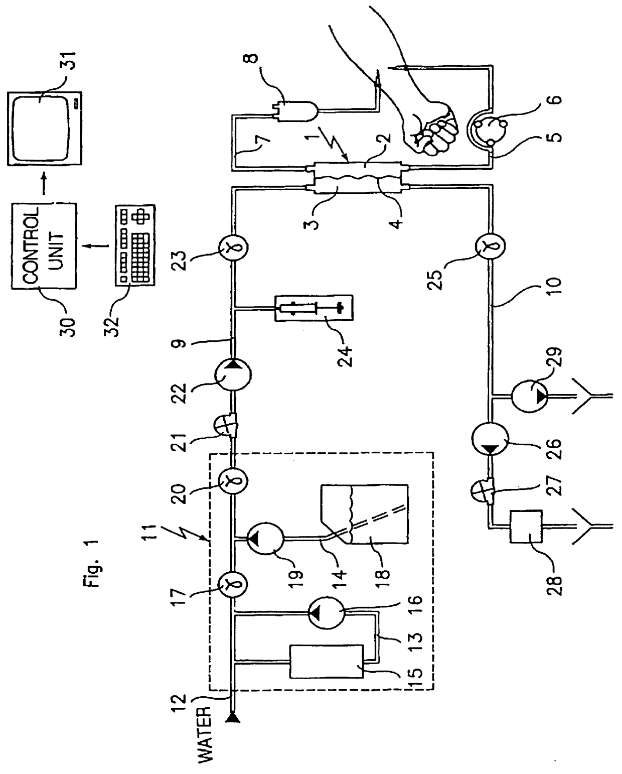 Method of determining a parameter indicative of the progress of an extracorporeal blood treatment