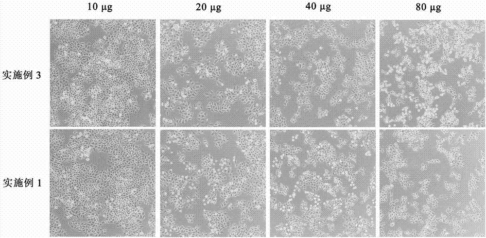 Morchella vulgaris, rhizoma polygonati and snowdrop active proteoglycan protein, as well as preparation method and application thereof