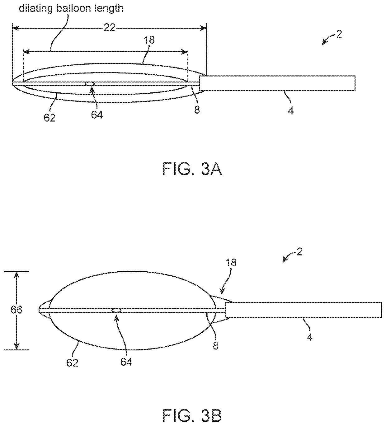 Apparatus and method for everting catheter for iud delivery and placement in the uterine cavity