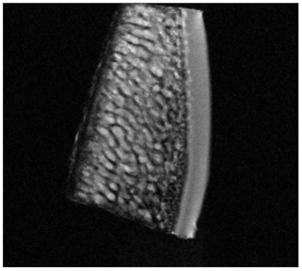 Wear evaluation method for articular cartilage injuries