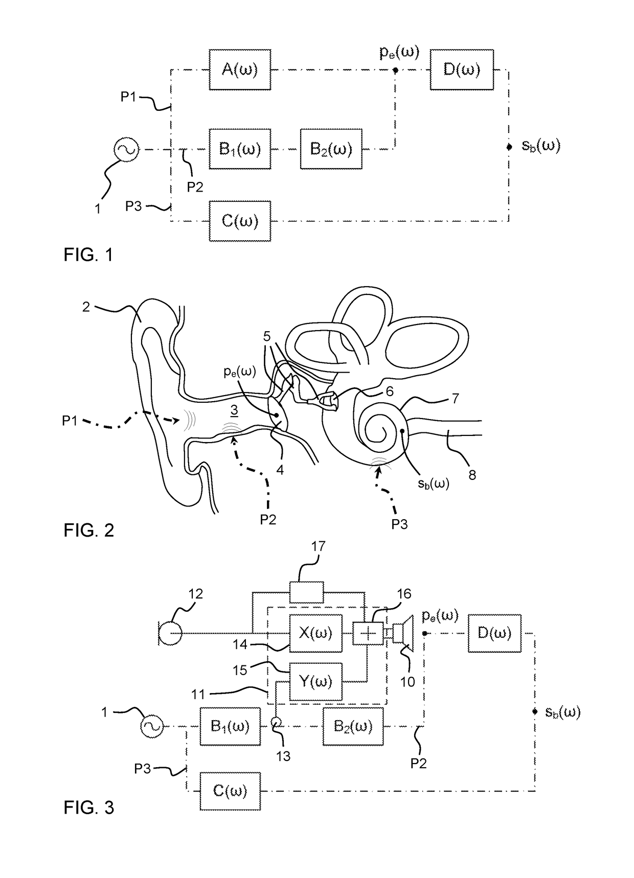 Controlling own-voice experience of talker with occluded ear