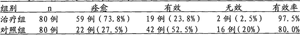 Traditional Chinese medicine naristillae for treating migraine