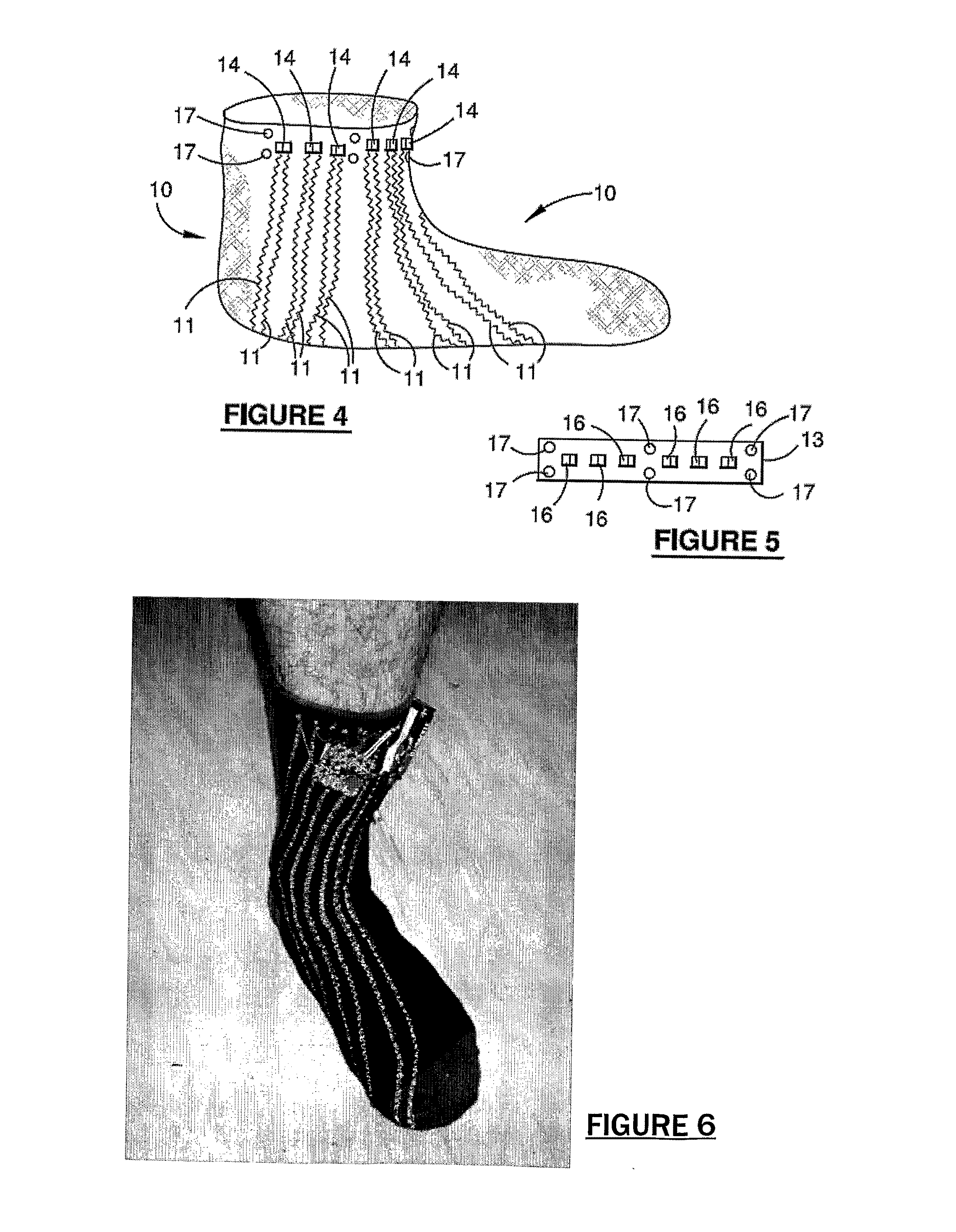 System, garment and method