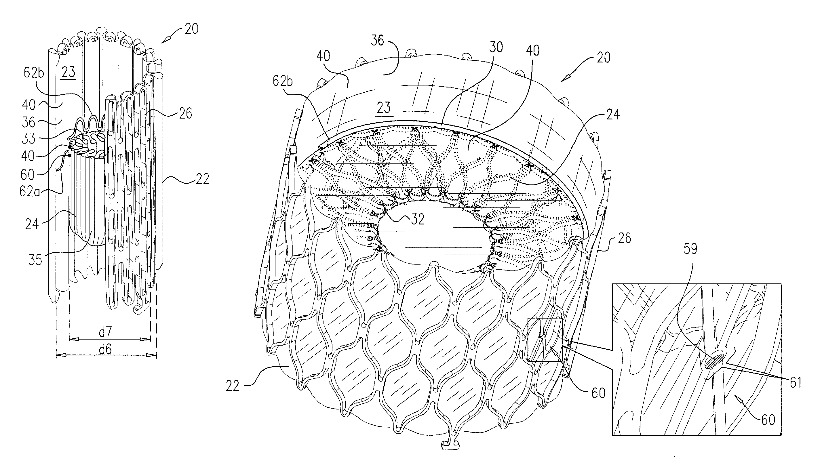 Percutaneously-deliverable mechanical valve