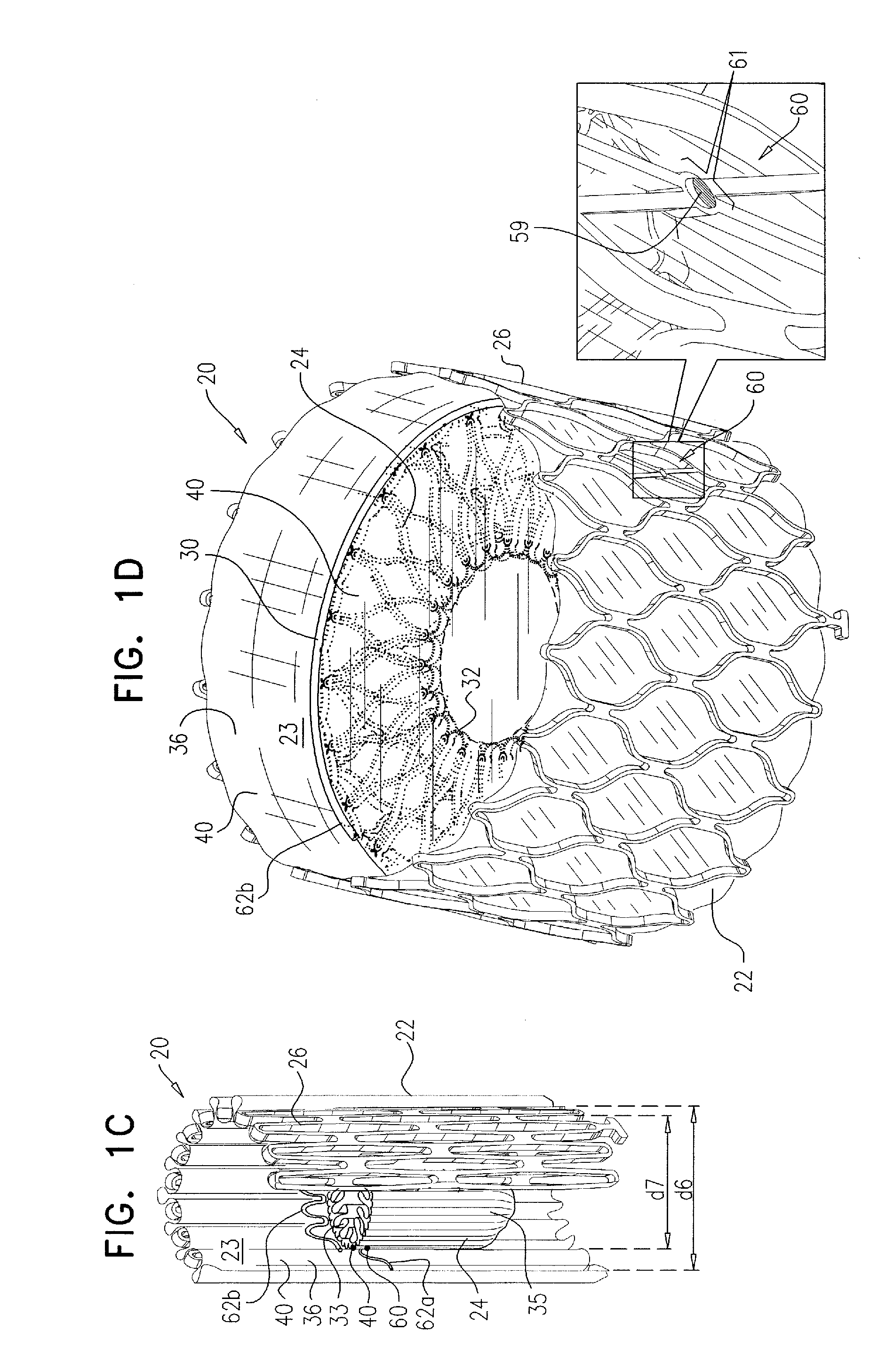 Percutaneously-deliverable mechanical valve