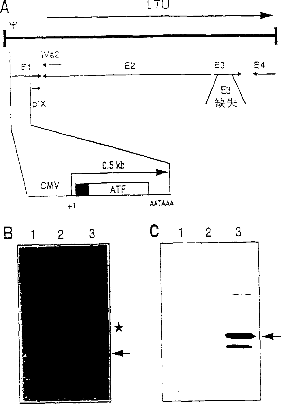 Adneovirus-mediated intratumoral delivery of angiogenesis antagonist for treatment of tumors