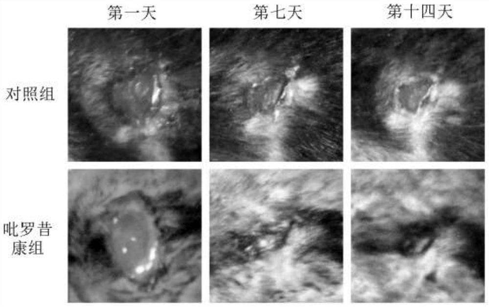 Application of piroxicam in preparation of medicine for treating skin ulcer and preparation method of medicine