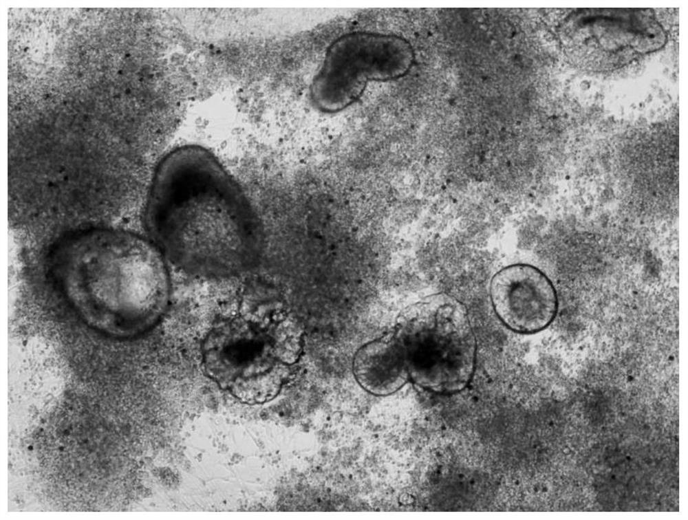 Culture medium and method for inducing human pluripotent stem cells to be differentiated into alveolar cells or alveolar organs