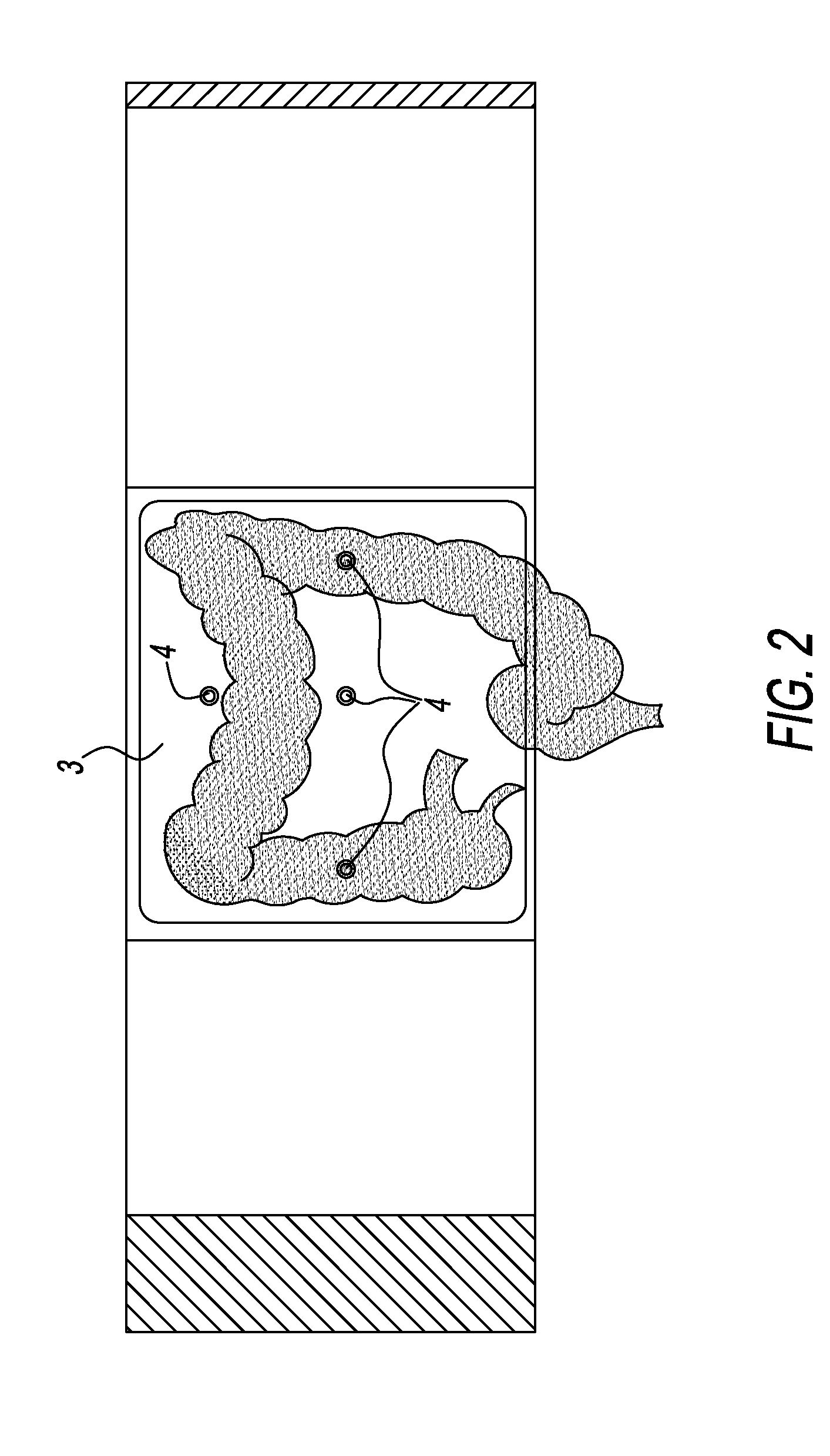 External Pneumatic Compression Device