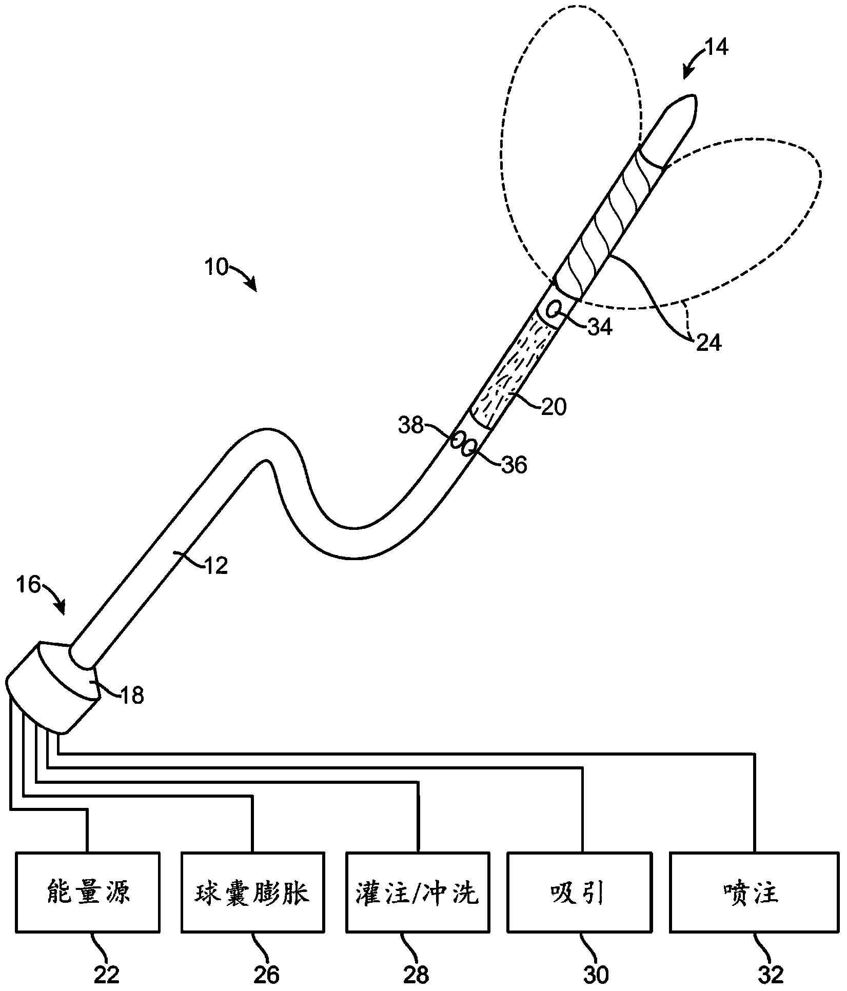 Automated image-guided tissue resection and treatment