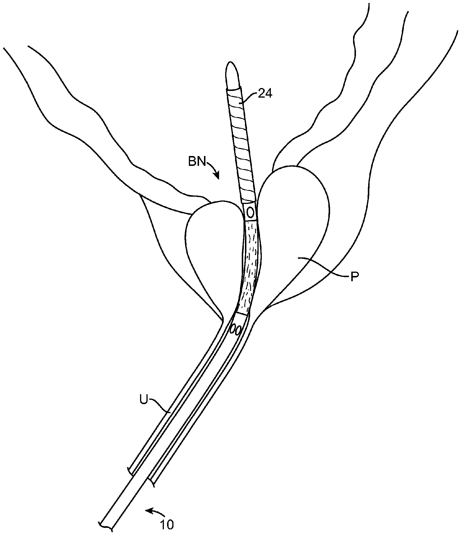 Automated image-guided tissue resection and treatment