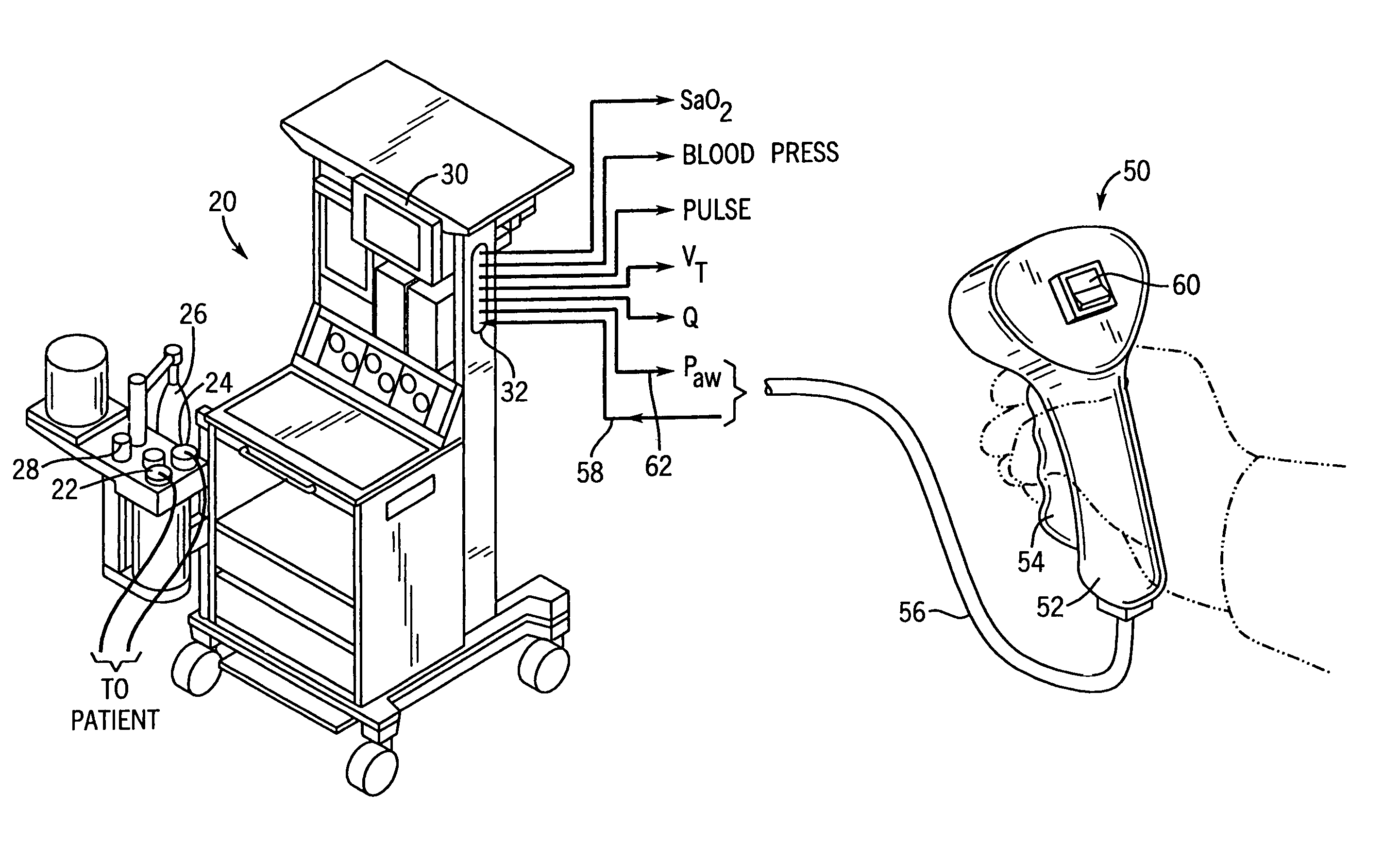 Remote control and tactile feedback system and method for medical apparatus