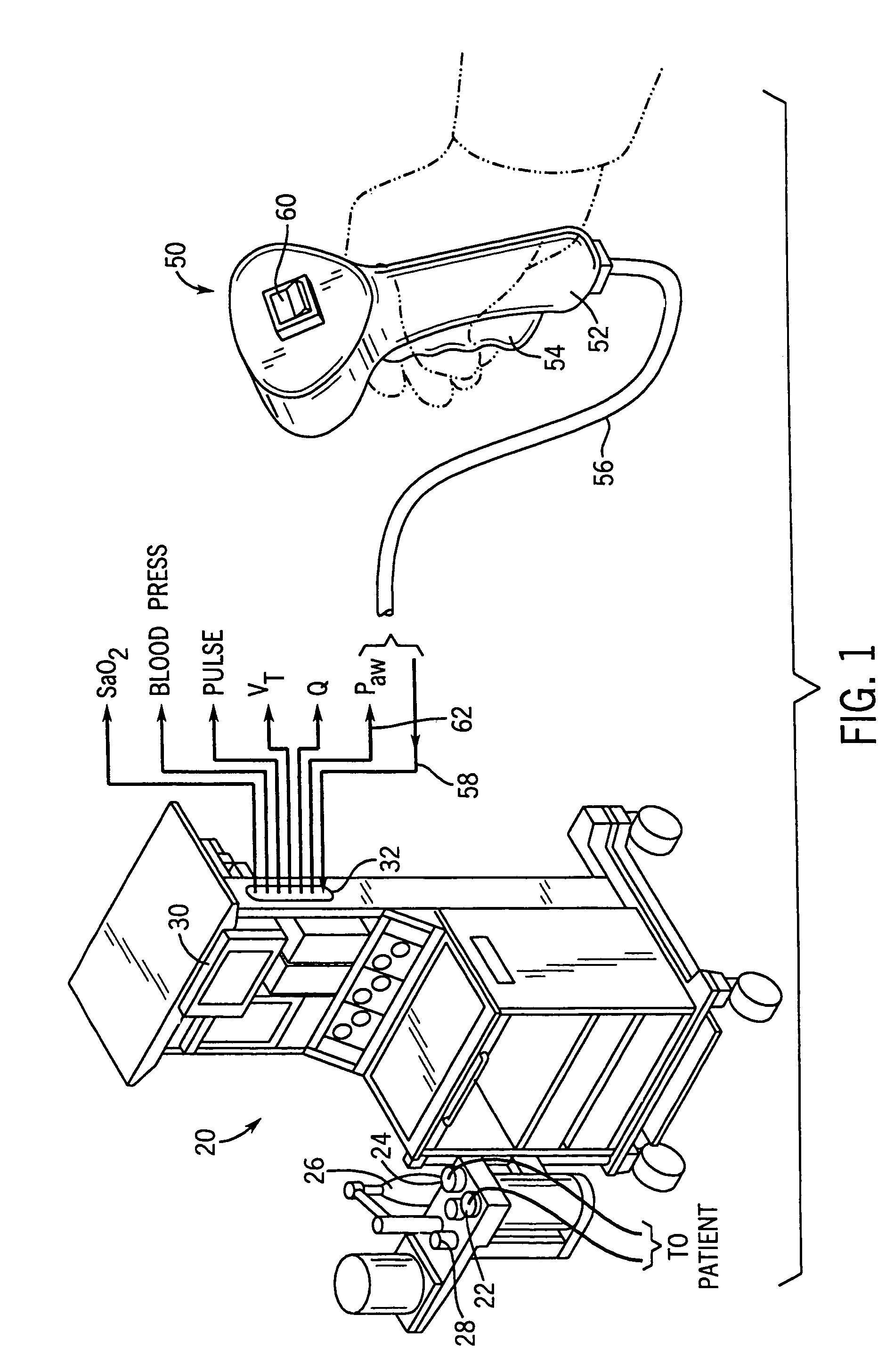 Remote control and tactile feedback system and method for medical apparatus