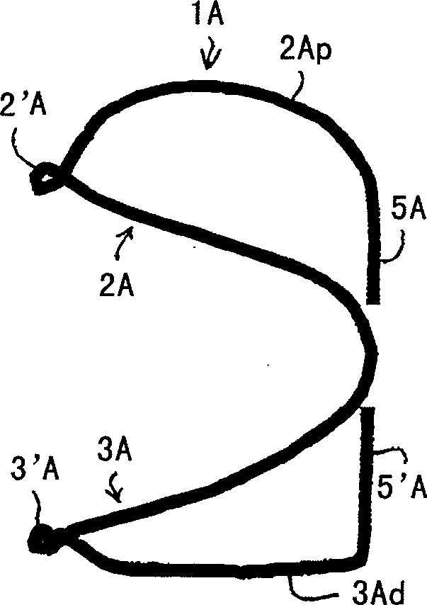 External brace for recovering venous valve function through tracting joint of venous valves