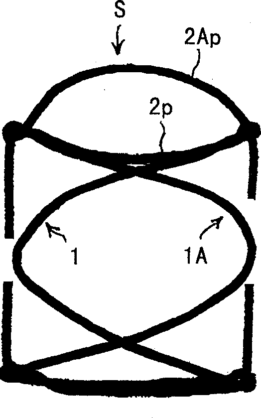 External brace for recovering venous valve function through tracting joint of venous valves