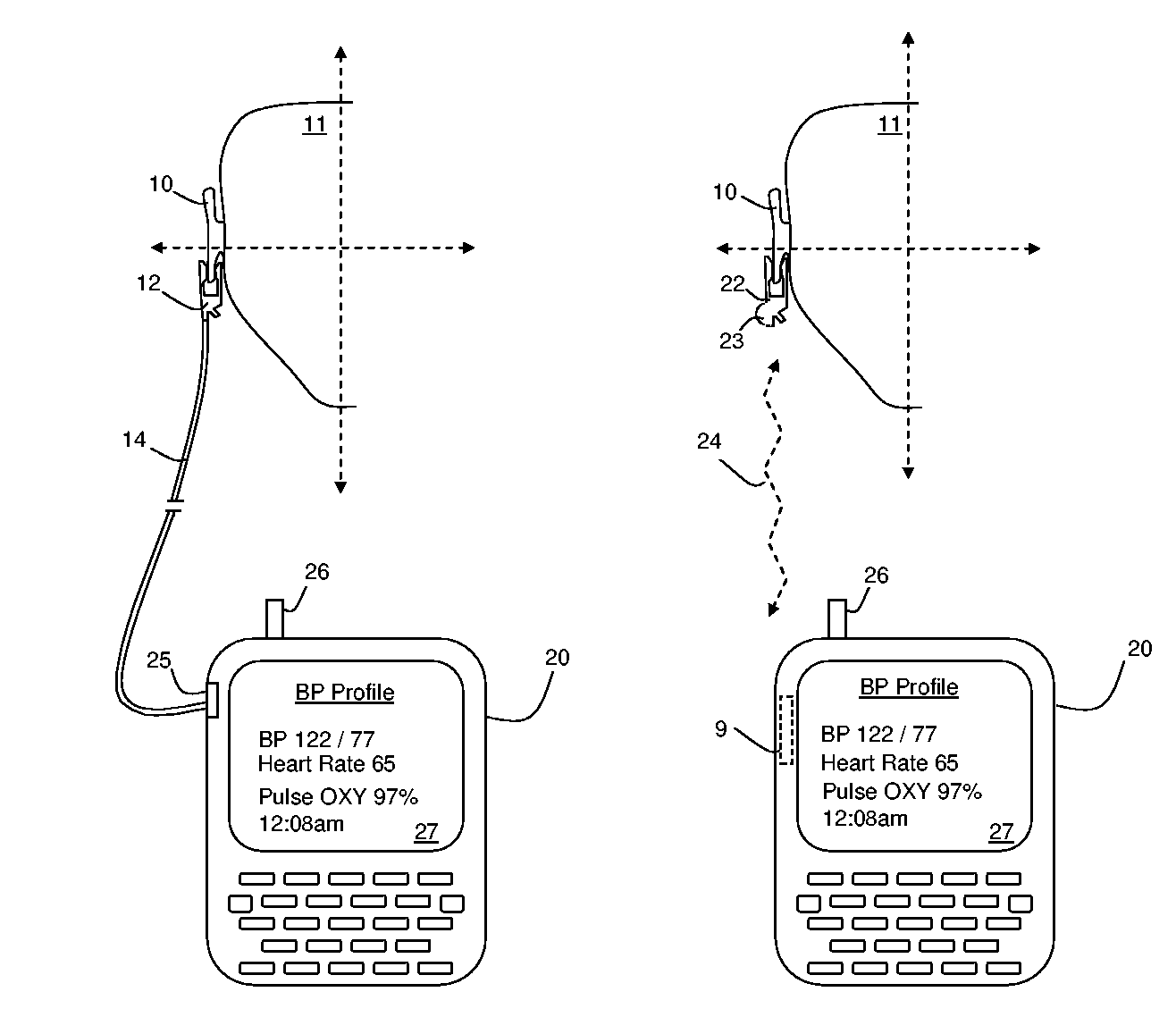 Vital signs monitor using an optical ear-based module