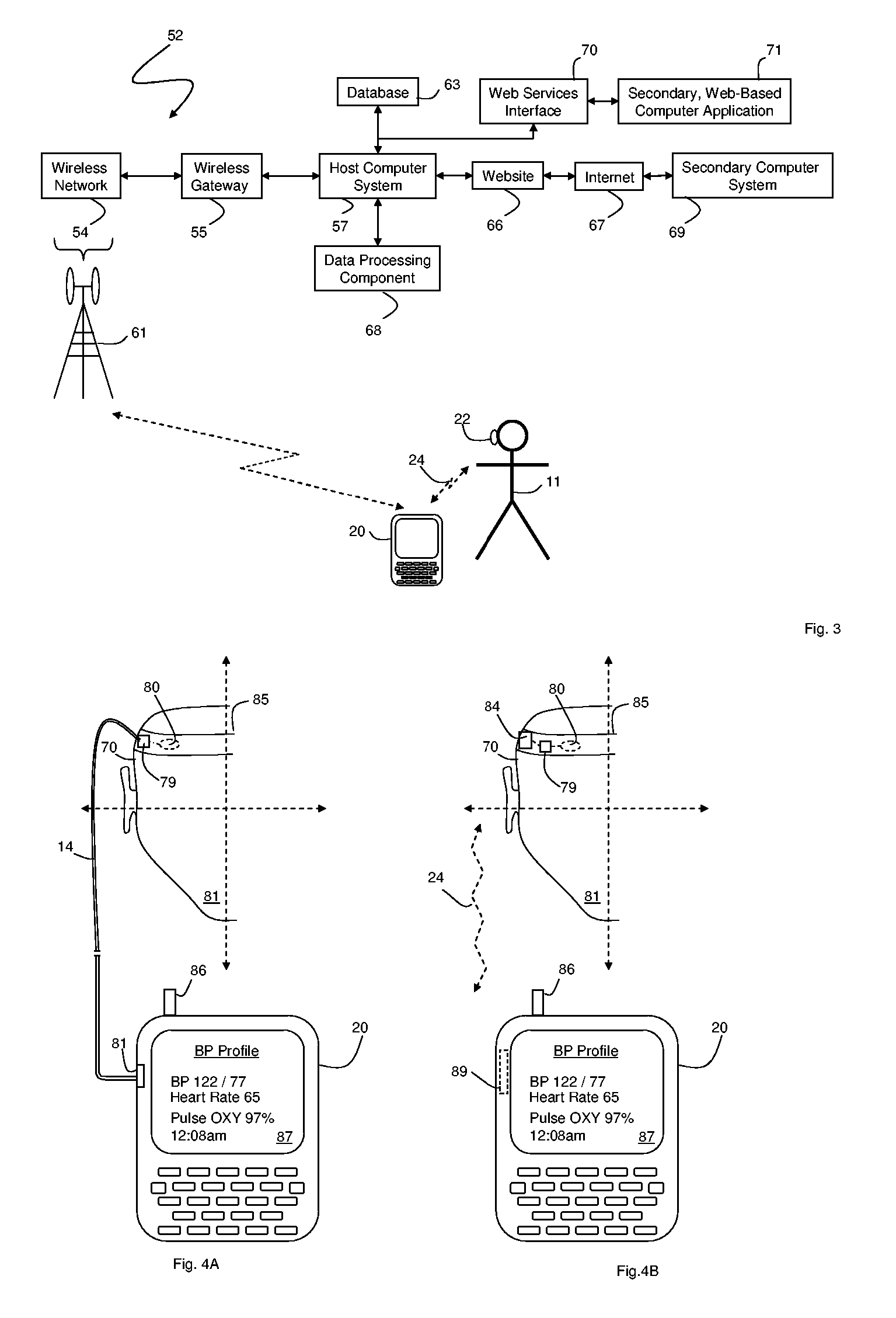 Vital signs monitor using an optical ear-based module