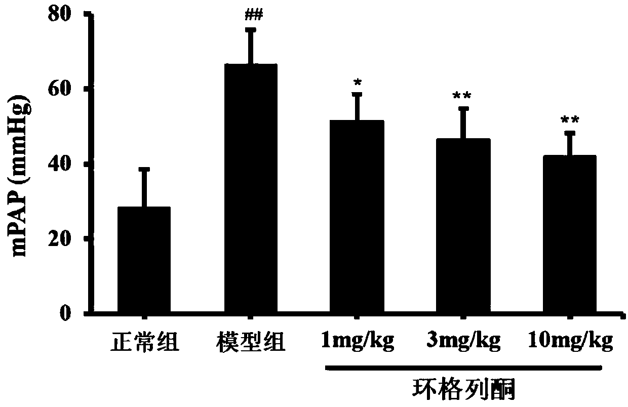 Application of ciglitazone in preparing drugs for treating pulmonary arterial hypertension