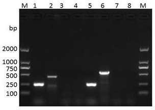 Bivalent inactivated vaccine for rabbit pasteurellosis and preparation method thereof