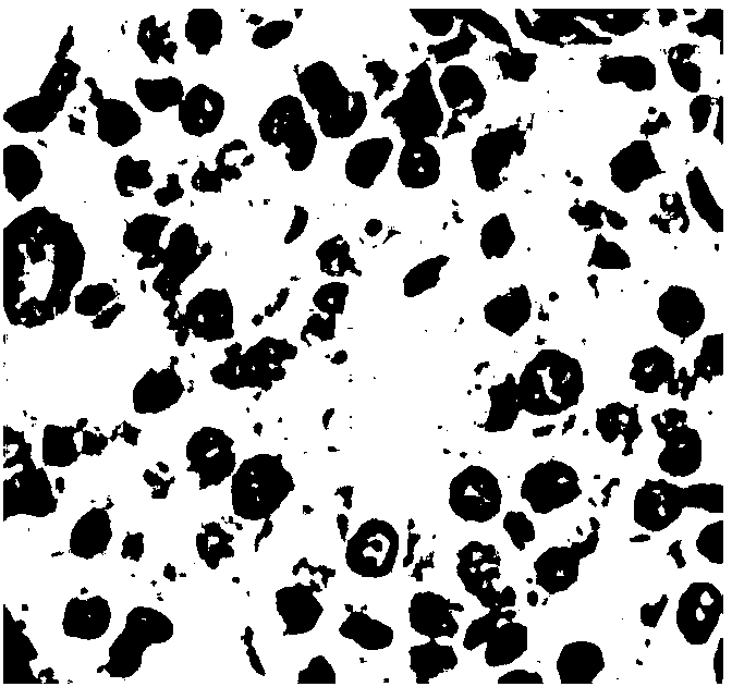 Artificial pancreas islet tissue and preparation and application thereof