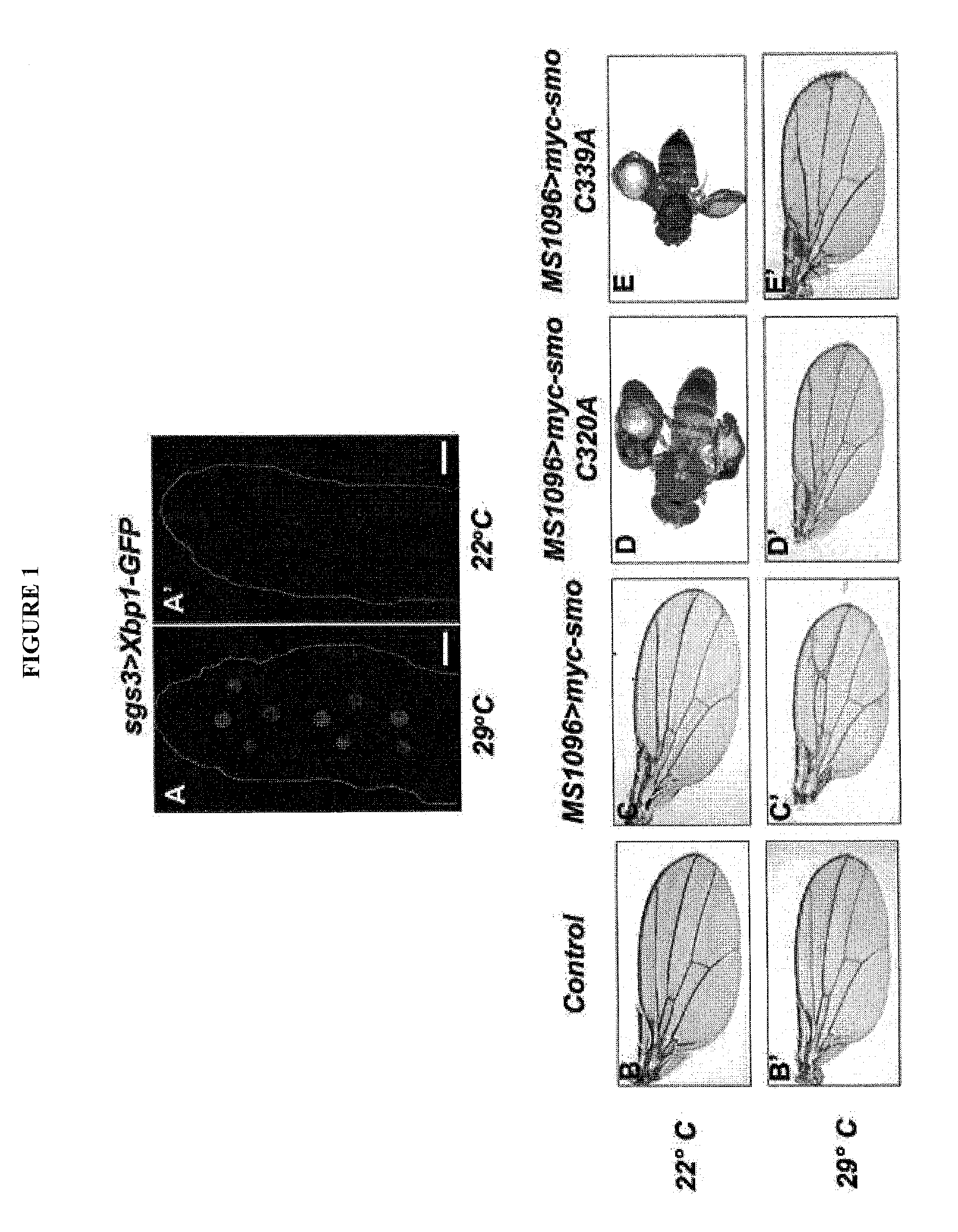 Use of Small Molecule Unfolder Protein Response Modulators to Treat Tumors With Active Sonic Hedgehog (SSH) Signaling Due To Smoothened (SMO) Mutation