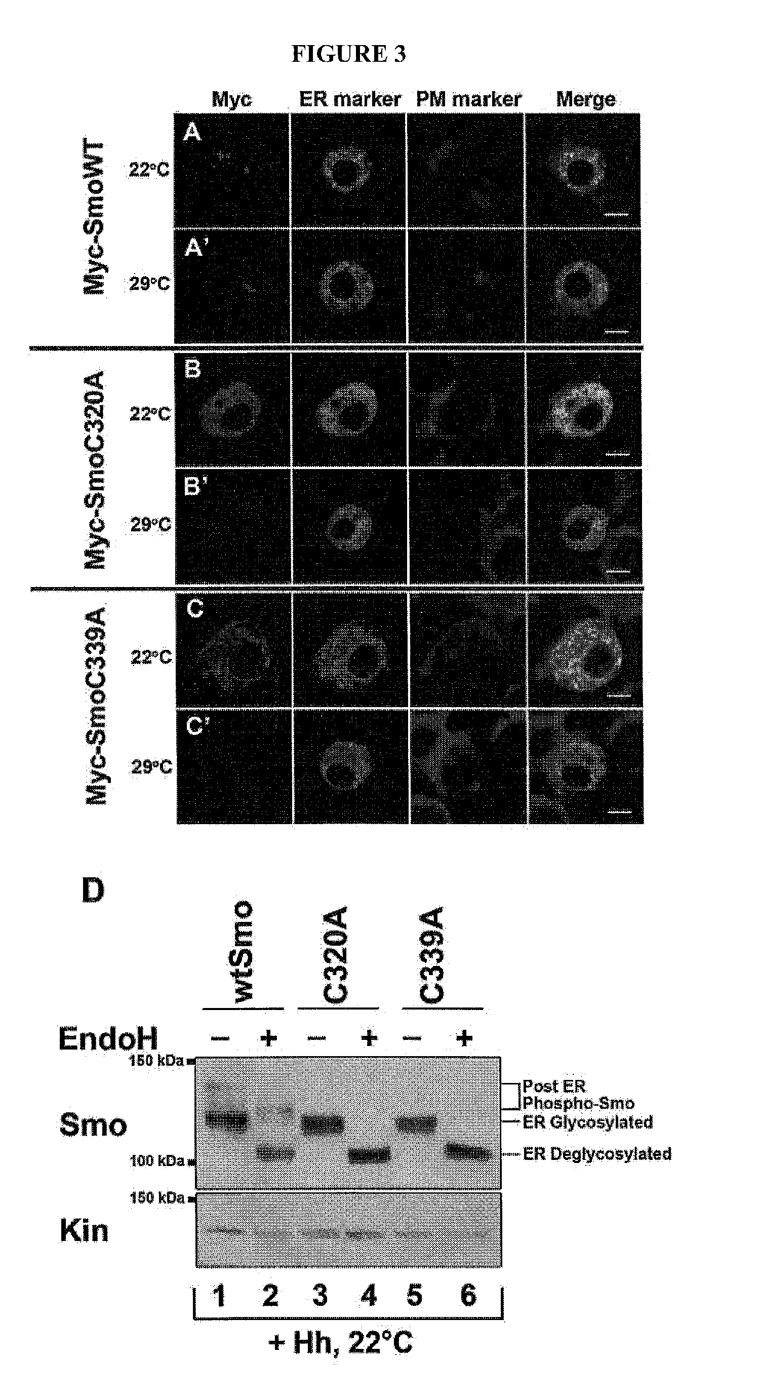 Use of Small Molecule Unfolder Protein Response Modulators to Treat Tumors With Active Sonic Hedgehog (SSH) Signaling Due To Smoothened (SMO) Mutation