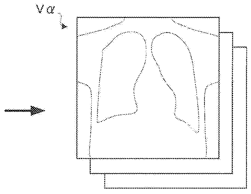 Image processing device