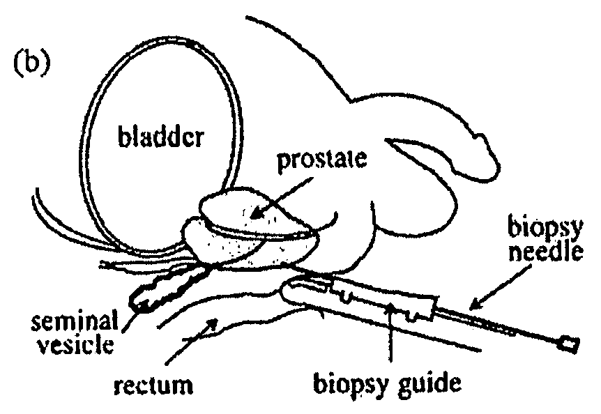 System and Method for Performing a Biopsy of a Target Volume and a Computing Device for Planning the Same