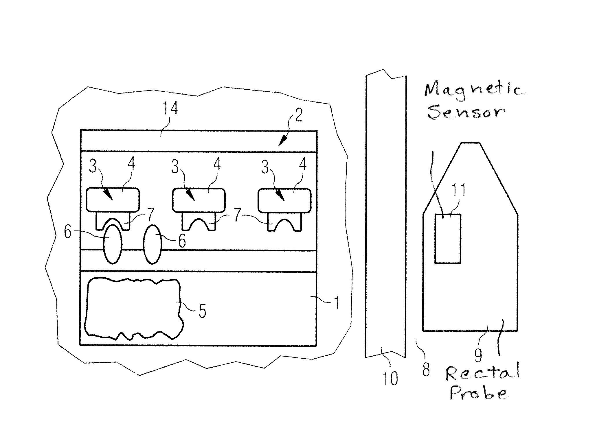 Screening test for recognizing prostate diseases and apparatus and diagnosis substance for carrying out the test