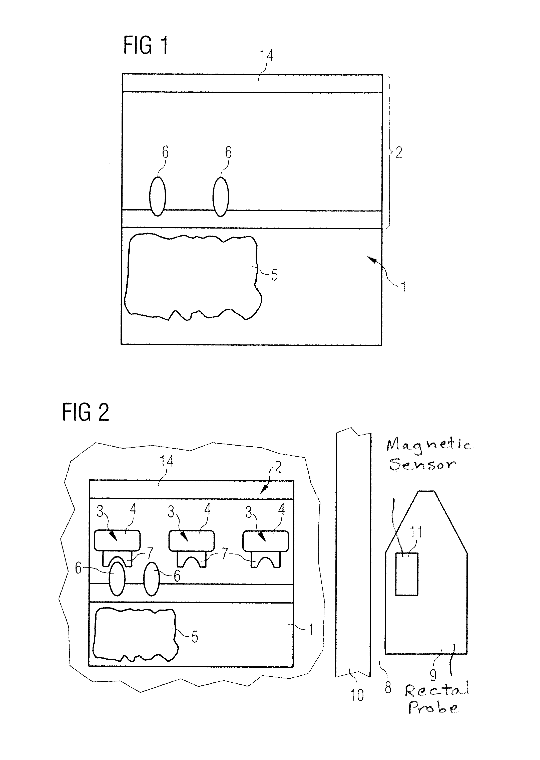 Screening test for recognizing prostate diseases and apparatus and diagnosis substance for carrying out the test