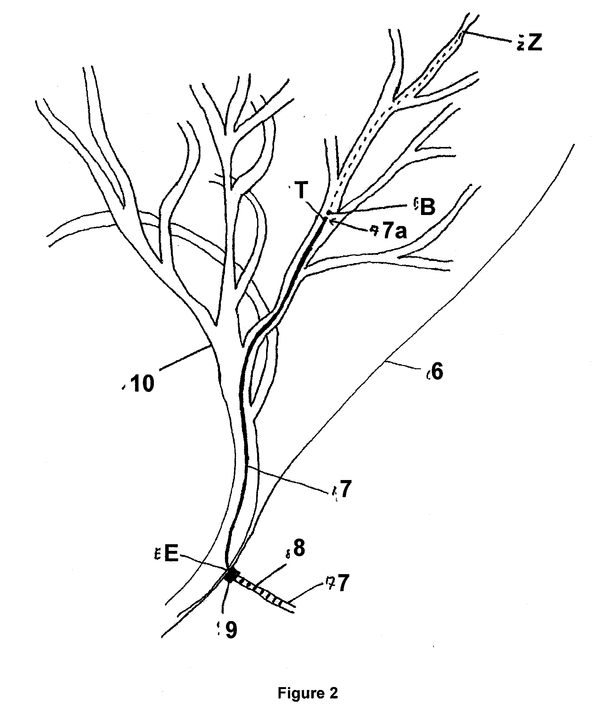 Method for ascertaining the position of a medical instrument in a body